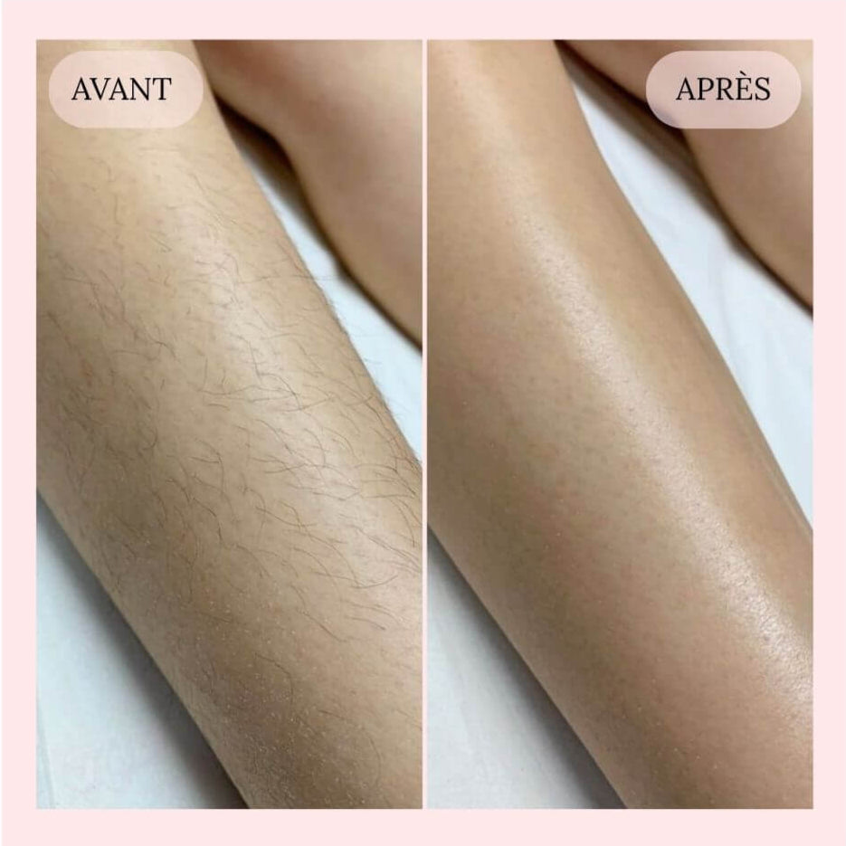 Rasoir 2 en 1 FogiaCil™